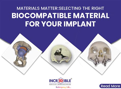  Jadeite: Un material biocompatible ideal para implantes óseos de última generación!